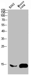 Western blot analysis of mouse-brain mouse-spinal-cord lysate, antibody was diluted at 2000. Secondary antibody was diluted at 1:20000