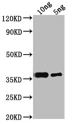 Western Blot Positive WB detected in Recombinant protein All lanes: RPB10 antibody at 1:2000 Secondary Goat polyclonal to rabbit IgG at 1/50000 dilution Predicted band size: 34.8 kDa Observed band size: 38 kDa