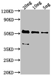 Western Blot Positive WB detected in Recombinant protein All lanes: MCP antibody at 1:2000 Secondary Goat polyclonal to rabbit IgG at 1/50000 dilution Predicted band size: 47.8 kDa Observed band size: 53 kDa