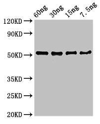 Western Blot Positive WB detected in Recombinant protein All lanes: D8L antibody at 3µg/ml Secondary Goat polyclonal to rabbit IgG at 1/50000 dilution Predicted band size: 52 kDa Observed band size: 52 kDa