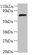Western blot All lanes: DNA ligase antibody at 2ug/ml + DH5a whole cell lysate Secondary Goat polyclonal to rabbit IgG at 1/10000 dilution Predicted band size: 74 kDa Observed band size: 74 kDa