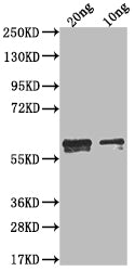 Western Blot Positive WB detected in Recombinant protein All lanes: N antibody at 1:2000 Secondary Goat polyclonal to rabbit IgG at 1/50000 dilution Predicted band size: 49.4 kDa Observed band size: 60 kDa