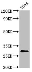 Western Blot Positive WB detected in Recombinant protein All lanes: S antibody at 5.7µg/ml Secondary Goat polyclonal to rabbit IgG at 1/50000 dilution Predicted band size: 29 kDa Observed band size: 29 kDa