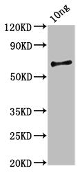 Western Blot Positive WB detected in Recombinant protein All lanes: vvhA antibody at 2.3ug/ml Secondary Goat polyclonal to rabbit IgG at 1/50000 dilution Predicted band size: 58 kDa Observed band size: 58 kDa