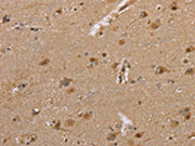 The image on the left is immunohistochemistry of paraffin-embedded Human brain tissue using CSB-PA324006(DLD Antibody) at dilution 1/35, on the right is treated with fusion protein. (Original magnification: ×200)