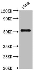 Western Blot Positive WB detected in Recombinant protein All lanes: fbpB antibody at 3.2ug/ml Secondary Goat polyclonal to rabbit IgG at 1/50000 dilution Predicted band size: 50 kDa Observed band size: 50 kDa