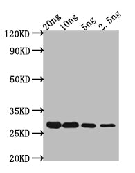 Western Blot Positive WB detected in Recombinant protein All lanes: CRTI antibody at 1:2000 Secondary Goat polyclonal to rabbit IgG at 1/50000 dilution Predicted band size: 24.2 kDa Observed band size: 56 kDa