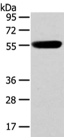 Gel: 8%SDS-PAGE, Lysate: 40 ug, Lane: Human fetal brain tissue, Primary antibody: CSB-PA324695(CBX4 Antibody) at dilution 1/250 dilution, Secondary antibody: Goat anti rabbit IgG at 1/8000 dilution, Exposure time: 1 minute