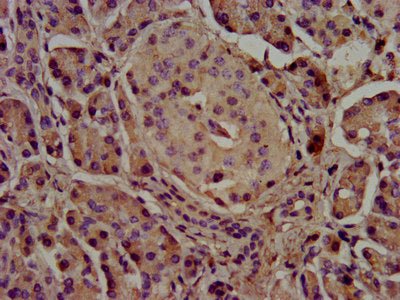 IHC image of CSB-PA325708LA01HU diluted at 1:500 and staining in paraffin-embedded human pancreatic tissue performed on a Leica BondTM system. After dewaxing and hydration, antigen retrieval was mediated by high pressure in a citrate buffer (pH 6....