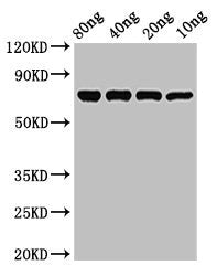 Western Blot Positive WB detected in Recombinant protein All lanes: NP antibody at 3µg/ml Secondary Goat polyclonal to rabbit IgG at 1/50000 dilution Predicted band size: 71 kDa Observed band size: 71 kDa