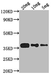 Western Blot Positive WB detected in Recombinant protein All lanes: phoP antibody at 1:2000 Secondary Goat polyclonal to rabbit IgG at 1/50000 dilution Predicted band size: 30.5 kDa Observed band size: 37 kDa