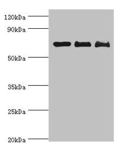 Western blot All lanes: CD6 antibody at 4ug/ml Lane 1: Hela whole cell lysate Lane 2: Jurkat whole cell lysate Lane 3: HT-29 whole cell lysate Secondary Goat polyclonal to rabbit IgG at 1/10000 dilution Predicted band size: 72, 69, 64, 65, 59, 61...