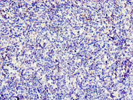Immunohistochemistry of paraffin-embedded human thymus tissue using CSB-PA326953ESR2HU at dilution of 1:100