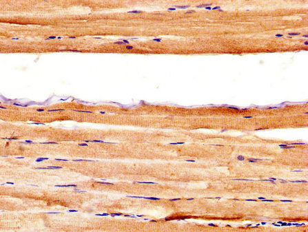 IHC image of CSB-PA326981LA01HU diluted at 1:400 and staining in paraffin-embedded human skeletal muscle tissue performed on a Leica BondTM system. After dewaxing and hydration, antigen retrieval was mediated by high pressure in a citrate buffer (...