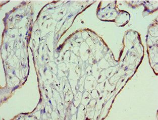 Immunohistochemistry of paraffin-embedded human placenta tissue using CSB-PA327046ESR2HU at dilution of 1:100