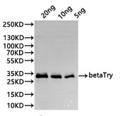 Western Blot Positive WB detected in: recombinant protein All lanes:betaTry Antibody at 1:1000 Secondary Goat polyclonal to rabbit IgG at 1/20000 dilution Predicted band size: 29.5 kDa Observed band size: 29.5 kDa