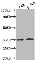 Western Blot Positive WB detected in Recombinant protein All lanes: DOT5 antibody at 1:2000 Secondary Goat polyclonal to rabbit IgG at 1/50000 dilution Predicted band size: 28.2 kDa Observed band size: 36 kDa