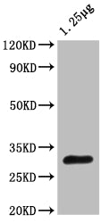 Western Blot Positive WB detected in: Escherichia coli lysate All lanes: OTSB antibody at 1:2000 Secondary Goat polyclonal to rabbit IgG at 1/50000 dilution Predicted band size: 30 kDa Observed band size: 30 kDa