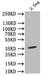 Western Blot Positive WB detected in: recombinant protein All lanes: stau Antibody at 1:1000 Secondary Goat polyclonal to rabbit IgG at 1/50000 dilution Predicted band size: 34 kDa Observed band size: 34 kDa