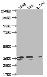 Western Blot Positive WB detected in Recombinant protein All lanes: Non-structural polyprotein antibody at 1:2000 Secondary Goat polyclonal to rabbit IgG at 1/50000 dilution Predicted band size: 31.4 kDa Observed band size: 36 kDa