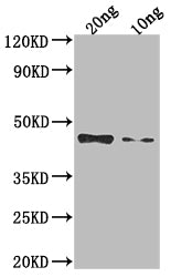 Western Blot Positive WB detected in Recombinant protein All lanes: Non-structural polyprotein antibody at 1:2000 Secondary Goat polyclonal to rabbit IgG at 1/50000 dilution Predicted band size: 37.1 kDa Observed band size: 47 kDa