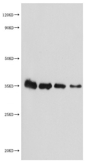 Western Blot Positive WB detected in Recombinant protein All lanes: MALD1 antibody at 1:2000 Secondary Goat polyclonal to rabbit IgG at 1/50000 dilution Predicted band size: 34 kDa Observed band size: 34 kDa