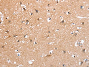 The image on the left is immunohistochemistry of paraffin-embedded Human brain tissue using CSB-PA332903(PSPN Antibody) at dilution 1/25, on the right is treated with synthetic peptide. (Original magnification: ×200)