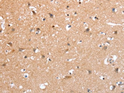 The image on the left is immunohistochemistry of paraffin-embedded Human brain tissue using CSB-PA332903(PSPN Antibody) at dilution 1/25, on the right is treated with synthetic peptide. (Original magnification: ×200)