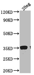 Western Blot Positive WB detected in Recombinant protein All lanes: RAD51 antibody at 1:2000 Secondary Goat polyclonal to rabbit IgG at 1/50000 dilution Predicted band size: 34.3 kDa Observed band size: 38 kDa