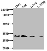 Western Blot Positive WB detected in Recombinant protein All lanes: Endochitinase B antibody at 1:2000 Secondary Goat polyclonal to rabbit IgG at 1/50000 dilution Predicted band size: 33.8 kDa Observed band size: 33 kDa
