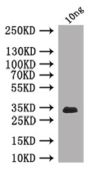 Western Blot Positive WB detected in: recombinant protein All lanes: Chc Antibody at 1:1000 Secondary Goat polyclonal to rabbit IgG at 1/50000 dilution Predicted band size: 33 kDa Observed band size: 33 kDa
