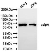 Western Blot Positive WB detected in: recombinant protein All lanes:slpA Antibody at 1:1000 Secondary Goat polyclonal to rabbit IgG at 1/20000 dilution Predicted band size: 51.7 kDa Observed band size: 60 kDa