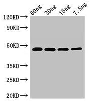 Western Blot Positive WB detected in Recombinant protein All lanes: PPX1 antibody at 2.7µg/ml Secondary Goat polyclonal to rabbit IgG at 1/50000 dilution Predicted band size: 48 kDa Observed band size: 48 kDa