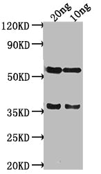 Western Blot Positive WB detected in Recombinant protein All lanes: SALM antibody at 1:2000 Secondary Goat polyclonal to rabbit IgG at 1/50000 dilution Predicted band size: 38 kDa Observed band size: 58 kDa