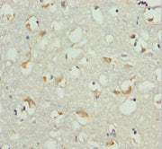 Immunohistochemistry of paraffin-embedded human brain tissue using CSB-PA335050DSR1HU at dilution of 1:100