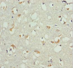 Immunohistochemistry of paraffin-embedded human brain tissue using CSB-PA335050DSR1HU at dilution of 1:100