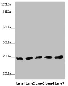 Western blot All lanes: EEF1B2 antibody at 0.91 ug/ml Lane 1: PC-3 whole cell lysate Lane 2: 293T whole cell lysate Lane 3: Hela whole cell lysate Lane 4: Jurkat whole cell lysate Lane 5: Raw264.7 whole cell lysate Secondary Goat polyclonal to rab...