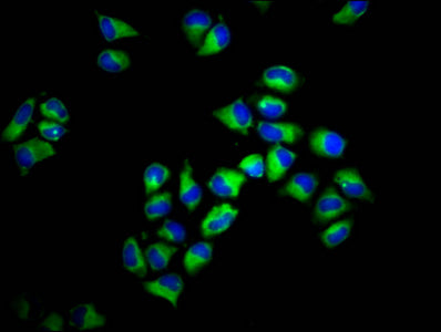 Immunofluorescence staining of Hela cells with CSB-PA335552LA01HU at 1:133, counter-stained with DAPI. The cells were fixed in 4% formaldehyde, permeabilized using 0.2% Triton X-100 and blocked in 10% normal Goat Serum. The cells were then incubat...
