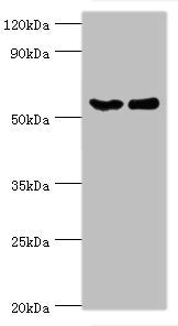 Western blot All lanes: CSTF2 antibody at 6ug/ml Lane 1: Hela whole cell lysate Lane 2: Jurkat whole cell lysate Secondary Goat polyclonal to rabbit IgG at 1/10000 dilution Predicted band size: 61, 60 kDa Observed band size: 61 kDa