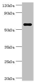 Western blot All lanes: CSTF2 antibody at 6ug/ml + Jurkat whole cell lysate Secondary Goat polyclonal to rabbit IgG at 1/10000 dilution Predicted band size: 61, 60 kDa Observed band size: 61 kDa