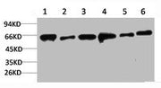 Western blot analysis of 1) Hela, 2) 293T, 3) C2C12, 4) 3T3, 5) Rat Heart, 6) Rat Brain using AMPKα2 Polyclonal Antibody.