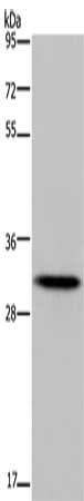 Gel: 10%SDS-PAGE, Lysate: 40 ug, Lane: Human fetal liver tissue, Primary antibody: CSB-PA337596(HOXB8 Antibody) at dilution 1/400, Secondary antibody: Goat anti rabbit IgG at 1/8000 dilution, Exposure time: 5 minutes