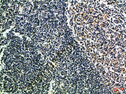Immunohistochemical analysis of paraffin-embedded Human-tonsil, antibody was diluted at 1:100