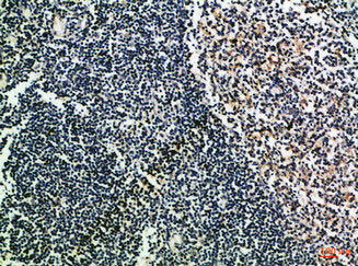 Immunohistochemical analysis of paraffin-embedded Human-tonsil, antibody was diluted at 1:100