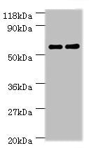 Western blot All lanes: Ces1c antibody at 2ug/ml Lane 1: Mouse liver tissue Lane 2: Rat liver tissue Secondary Goat polyclonal to rabbit IgG at 1/10000 dilution Predicted band size: 62 kDa Observed band size: 62 kDa