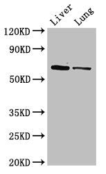 Western Blot Positive WB detected in: Mouse liver tissue, Rat lung tissue All lanes: Ces1c antibody at 5µg/ml Secondary Goat polyclonal to rabbit IgG at 1/50000 dilution Predicted band size: 62 kDa Observed band size: 62 kDa