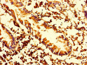 Immunohistochemistry of paraffin-embedded human appendix tissue using CSB-PA338892LA01HU at dilution of 1:100