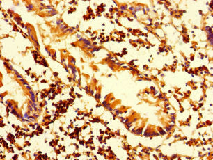 Immunohistochemistry of paraffin-embedded human appendix tissue using CSB-PA338892LA01HU at dilution of 1:100