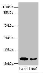 Western blot All lanes: PRDX2 antibody at 9ug/ml Lane 1: Mouse liver tissue Lane 2: Mouse spleen tissue Secondary Goat polyclonal to rabbit IgG at 1/10000 dilution Predicted band size: 22, 16 kDa Observed band size: 22 kDa