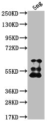Western Blot Positive WB detected in Recombinant protein All lanes: TFC3 antibody at 1:2000 Secondary Goat polyclonal to rabbit IgG at 1/50000 dilution Predicted band size: 56.1 kDa Observed band size: 63 kDa
